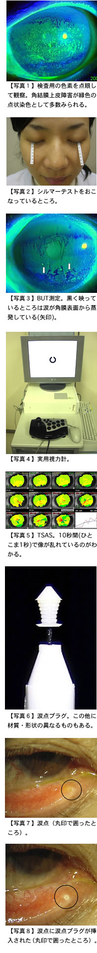 ドライアイについて